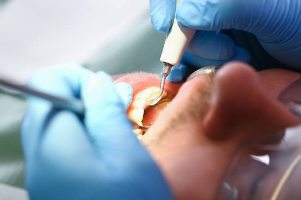 Best Dental Abscess Treatment in Roanoke Rapids, NC